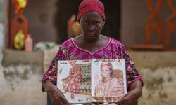 Afrika'da cilt beyazlatma ürünleri kamu sağlığını tehdit ediyor
