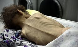İsrail'in kıtlığı dayattığı Gazze Şeridi'nde son 24 saatte 2’si çocuk 4 kişi daha açlıktan hayatını kaybetti