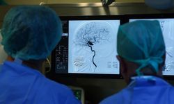 Erken tedavi ve rehabilitasyon, inme sonrası kalıcı hasar riskini düşürüyor