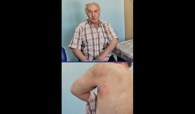 Burdur'da sahipsiz köpeklerin saldırdığı kişi yaralandı