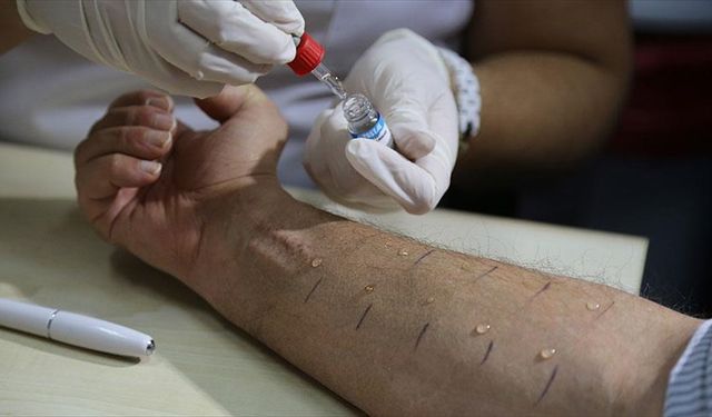 Türkiye'de toplumun yüzde 20'si alerjik belirtiler gösteriyor