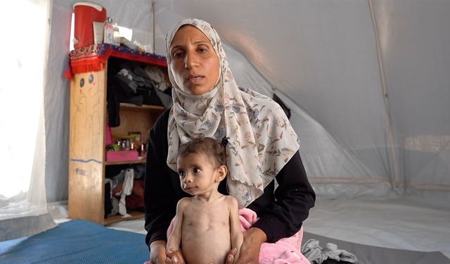 İsrail ablukası altındaki Gazze'de Zekeriyya bebek, yetersiz beslenmeyle mücadele ediyor