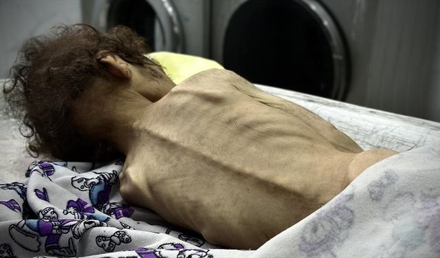 İsrail'in kıtlığı dayattığı Gazze Şeridi'nde son 24 saatte 2’si çocuk 4 kişi daha açlıktan hayatını kaybetti