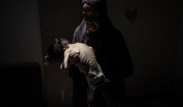 İsrail'in kıtlığı dayattığı Gazze'de son 24 saatte 4 kişi daha açlıktan hayatını kaybetti