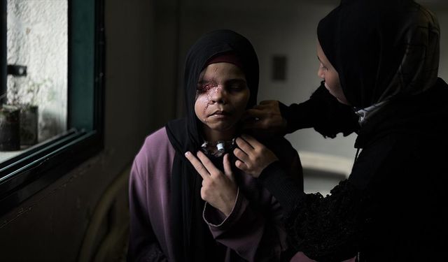 İsrail saldırısı nedeniyle yüzü tanınmaz hale gelen 15 yaşındaki Gazzeli Neda'nın 'hayatı karardı'