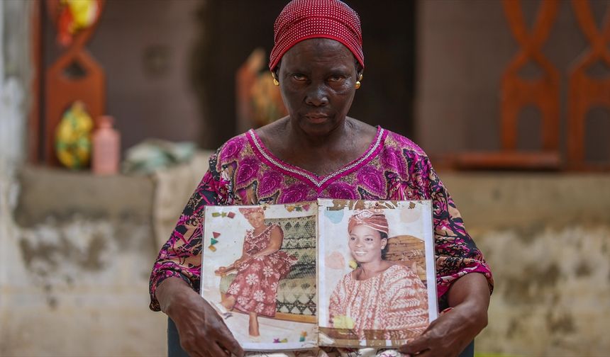 Afrika'da cilt beyazlatma ürünleri kamu sağlığını tehdit ediyor
